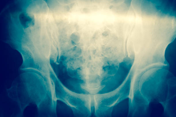 Close up bone  x-ray medical science background