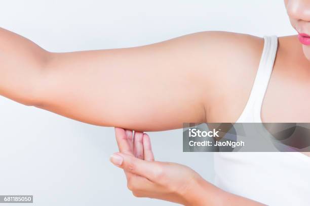 Asian Woman Showing Her Fat Upper Arm Stock Photo - Download Image Now - Arm, Fat - Nutrient, Women