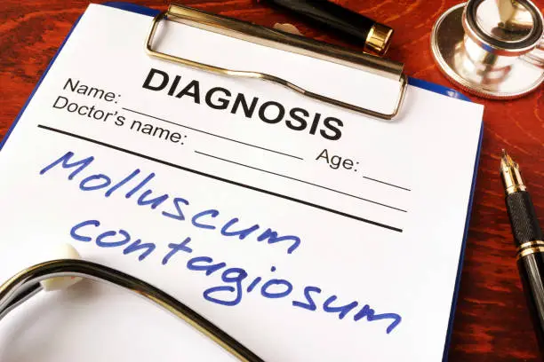 Molluscum contagiosum (MC) written in a document on a table.