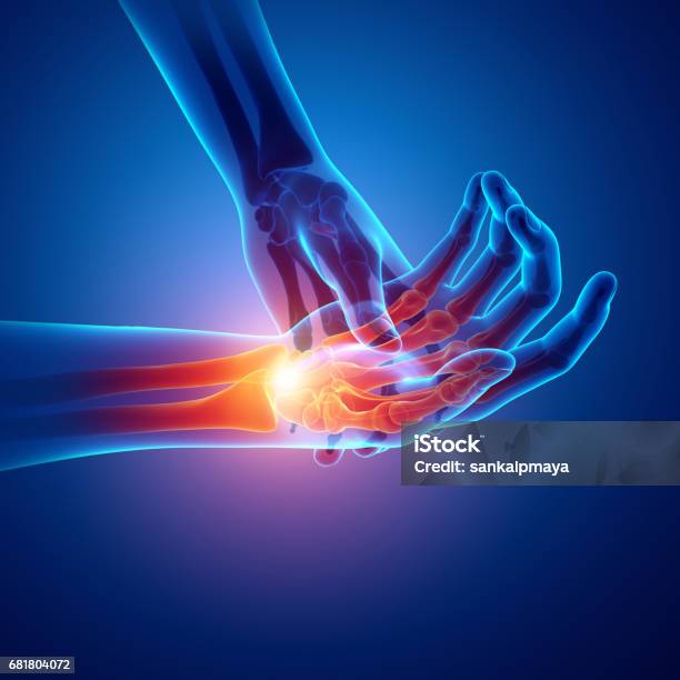 Men Feeling The Wrist Pain Stock Photo - Download Image Now - Hand, Pain, Wrist