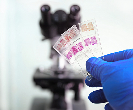 Glass slides in the laboratory. Hand in blue glove holding glass organ samples. Histological examination. The microscope in the background blurred. Pathologist at work.