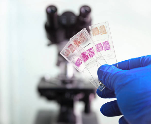 Glass slides in the laboratory Glass slides in the laboratory. Hand in blue glove holding glass organ samples. Histological examination. The microscope in the background blurred. Pathologist at work. human tissue stock pictures, royalty-free photos & images