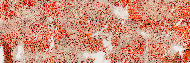 full frame abstract microscopic detail of a human fatty liver