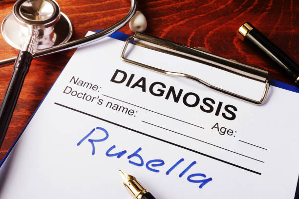 istock Medical form with diagnosis Rubella on a clipboard. 682578892