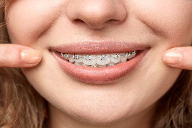 istock curly hair woman with brackets 682789796