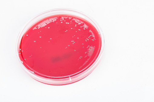 red blood petri dish on white background