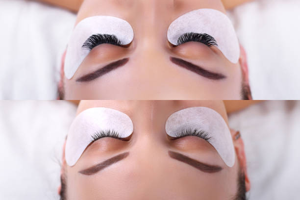 istock Eyelash Extension Procedure. Female eyes before and after 683411790