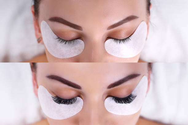 istock Eyelash Extension Procedure. Female eyes before and after 683411828