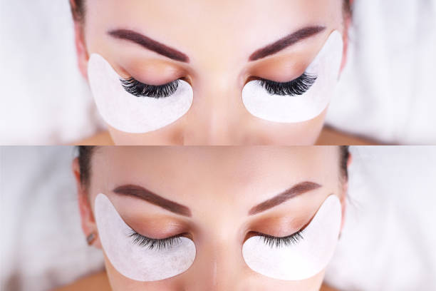 istock Eyelash Extension Procedure. Female eyes before and after 683411874
