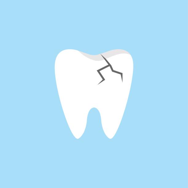 Cracked tooth flat icon. Cracked tooth flat icon, Dental and medicine, vector graphics, a colorful solid pattern on a blue background, eps 10. peeling off stock illustrations