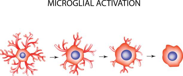 마이크로글리아의 활성화. 신경세포. 신경 세포. 인포그래픽. 격리된 배경의 벡터 그림입니다. - 마이크로글리아 stock illustrations