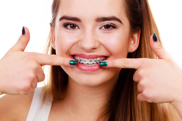 istock Woman showing her teeth with braces 683936662