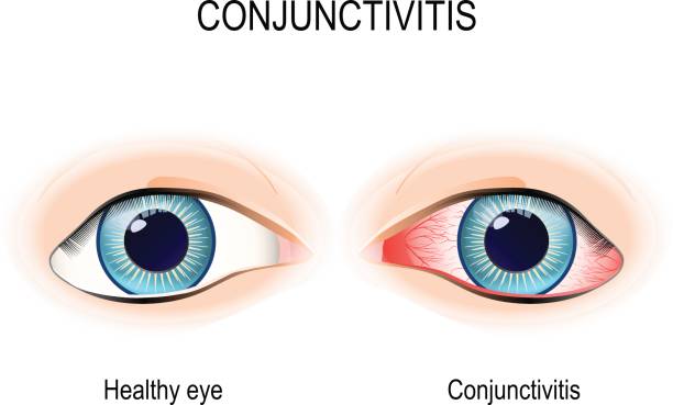 Ojos Rojos Vectores Libres de Derechos - iStock Ojos Rojos Vectores Libres de Derechos - iStock