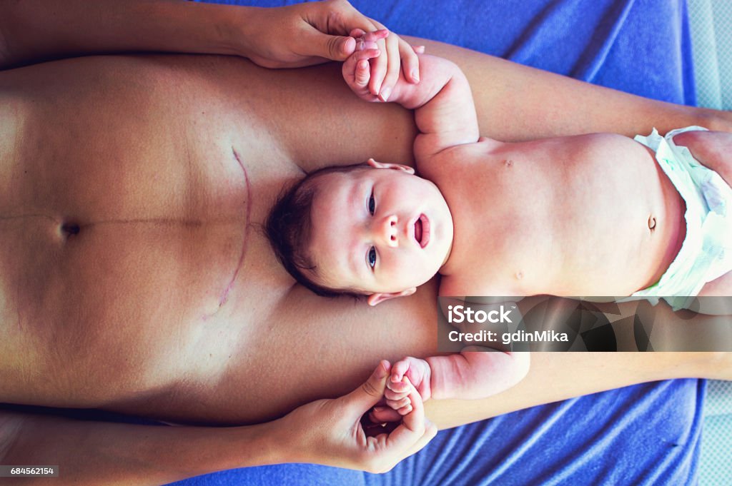 Cesarean Section C-Section Mother and Baby Caesarean Section Stock Photo