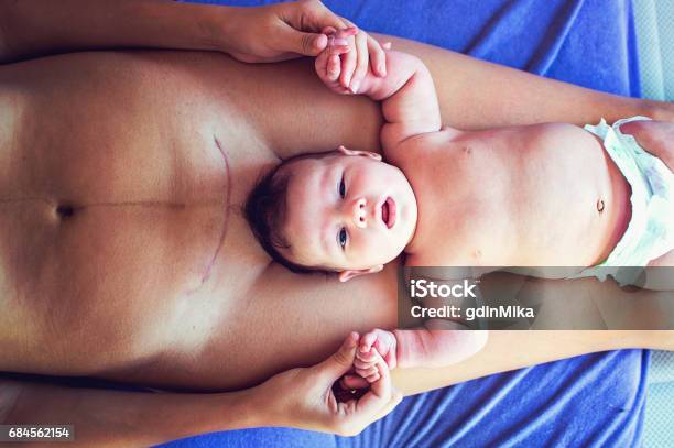 Cesarean Section Csection Mother And Baby Stock Photo - Download Image Now - Caesarean Section, Scar, Mother
