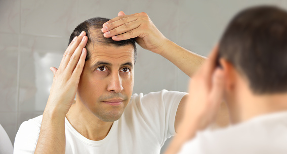 man controls hair loss and unhappy gazing at you in the mirror