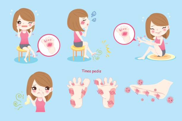 woman with tinea pedis woman feel pain with tinea pedis on blue background tinea stock illustrations