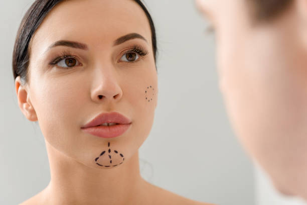 istock Calm woman with perforation lines watching at doctor 685846454