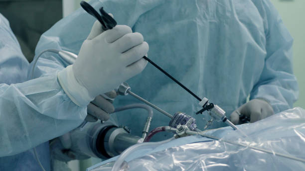 istock Laparoscopic surgery of the abdomen 686684618