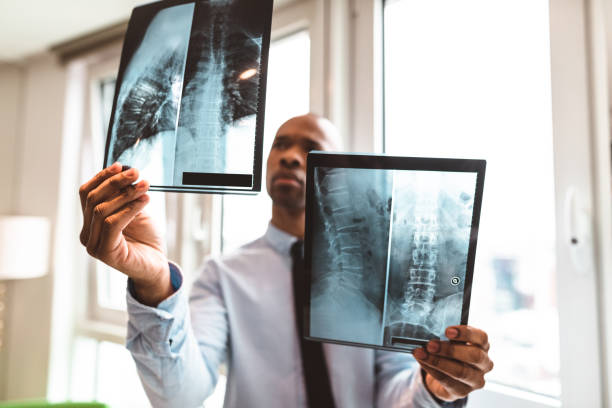 의사 사무실에서 x-레이 읽고 - human spine mri scan x ray doctor 뉴스 사진 이미지