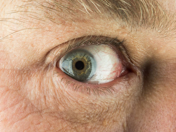 istock Close up of Male Eye 687593272