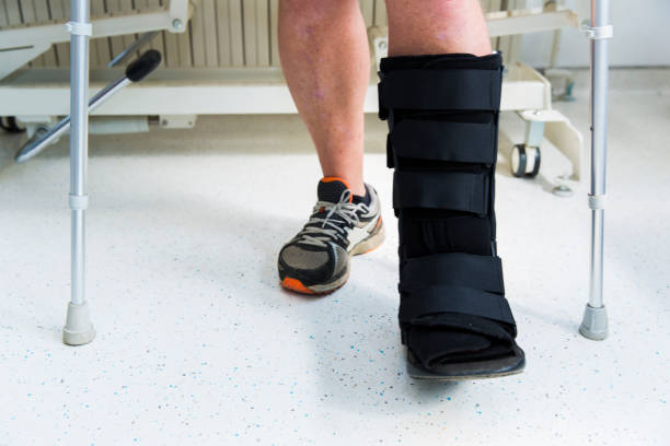 Muscular athlete with Walking boot for achilles tendon treatment Muscular athlete with Walking boot for achilles tendon treatment nylon fastening tape stock pictures, royalty-free photos & images