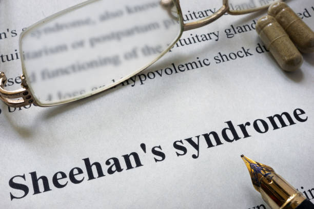 istock Paper with words Sheehan syndrome  and glasses. 687912338