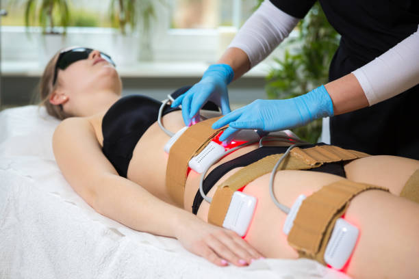 Woman receiving slimming lipo laser therapy in spa Beautician conducting fat reducting therapy with cold medical laser laser fat removal stock pictures, royalty-free photos & images