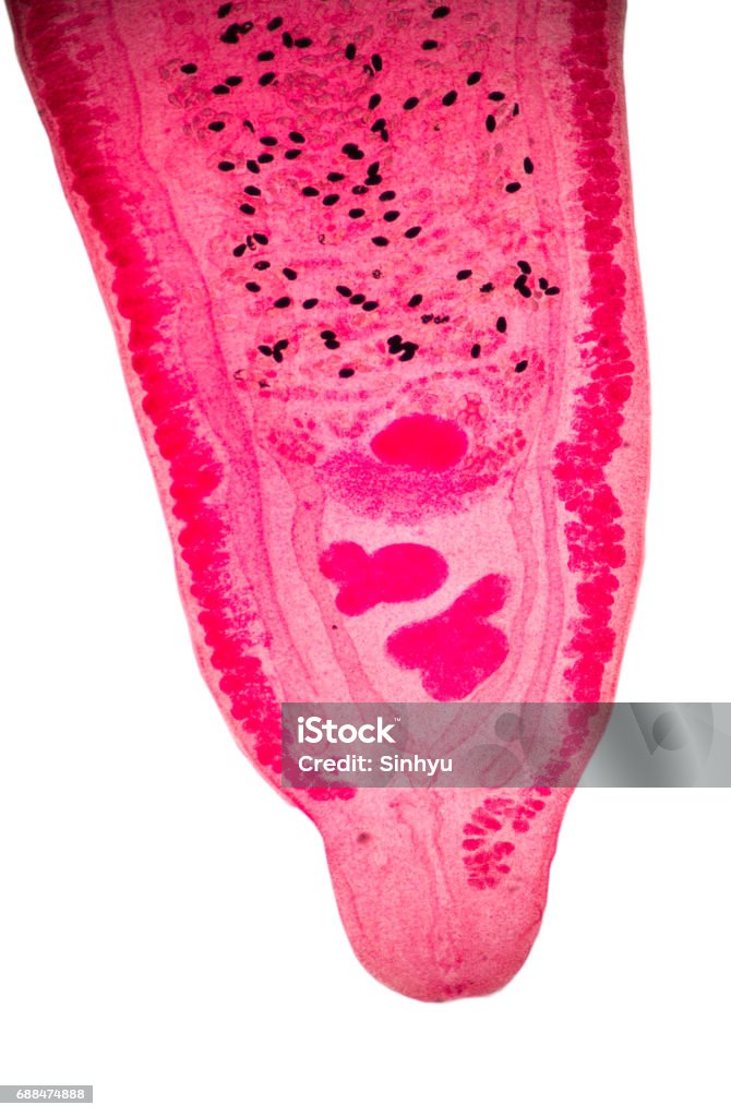 parasite under microscope view. Infectious Disease Stock Photo