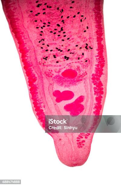 Parasite Under Microscope View Stock Photo - Download Image Now - Infectious Disease, Intestine, Parasitic