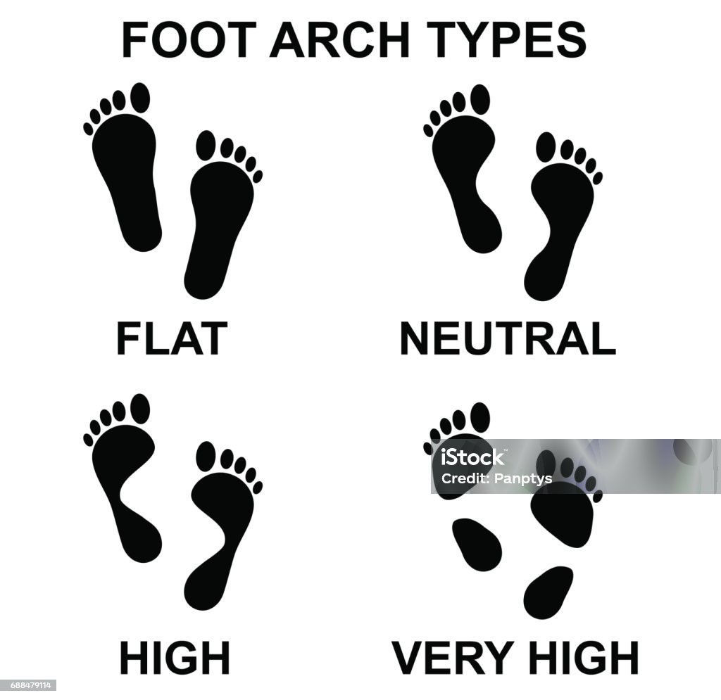 Foot arch types vector icon set. Vector art: types of foot arch. Foot stock vector