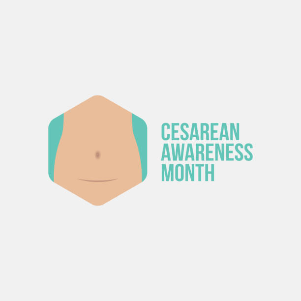 ilustrações de stock, clip art, desenhos animados e ícones de cesarean awareness - cesarean