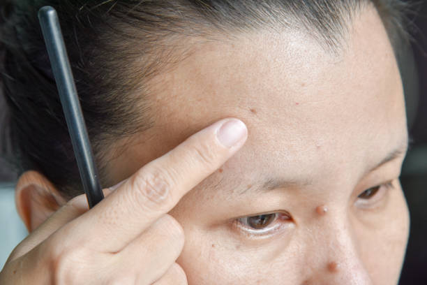 istock asian woman point mole on her face, prepared to remove 689580176