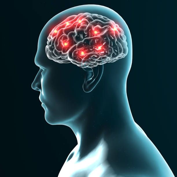 istock Brain degenerative diseases, Parkinson, synapses, neurons, Alzheimer's, 690363776
