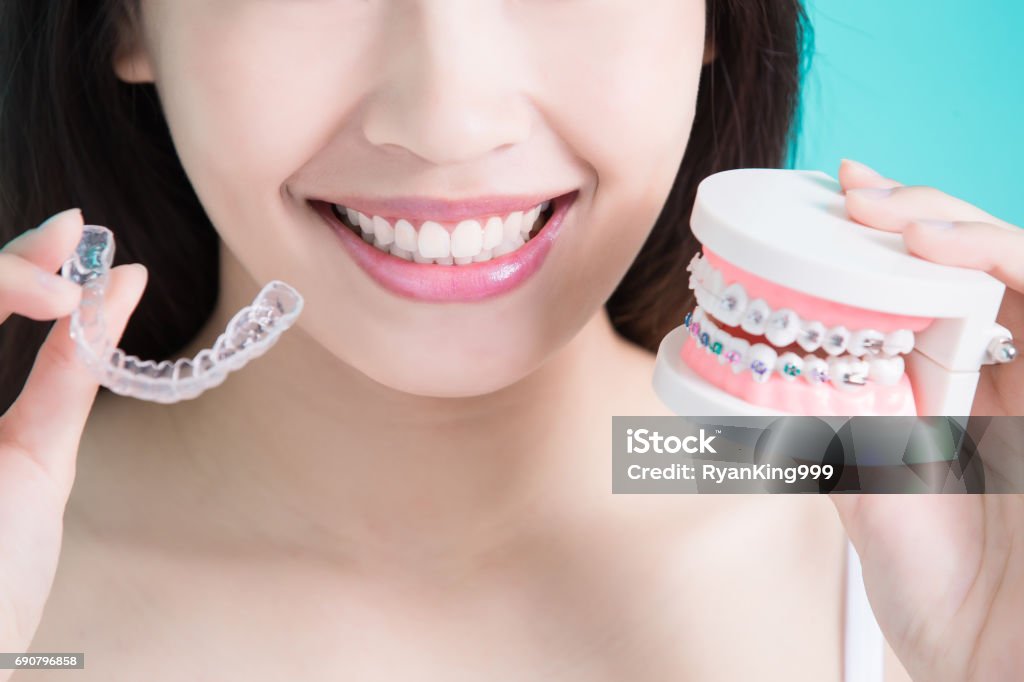 healthy dental concept woman choicce different brace on green background Dental Braces Stock Photo