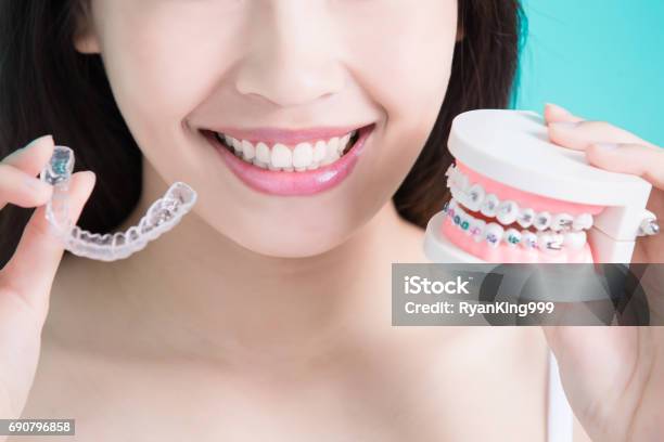 Healthy Dental Concept Stock Photo - Download Image Now - Dental Braces, Dental Aligner, Teeth