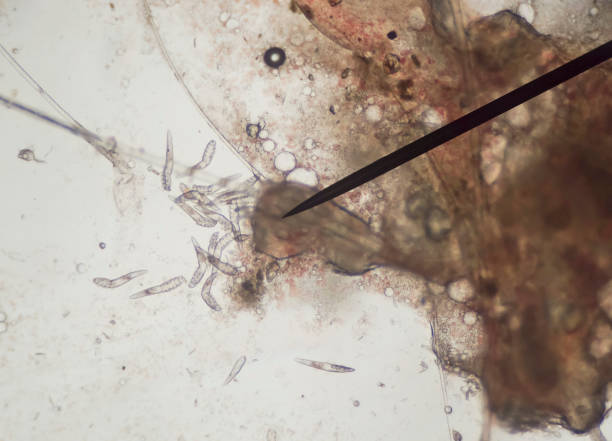 Демодекс клещ фото под микроскопом Демодекс клещ фото под микроскопом