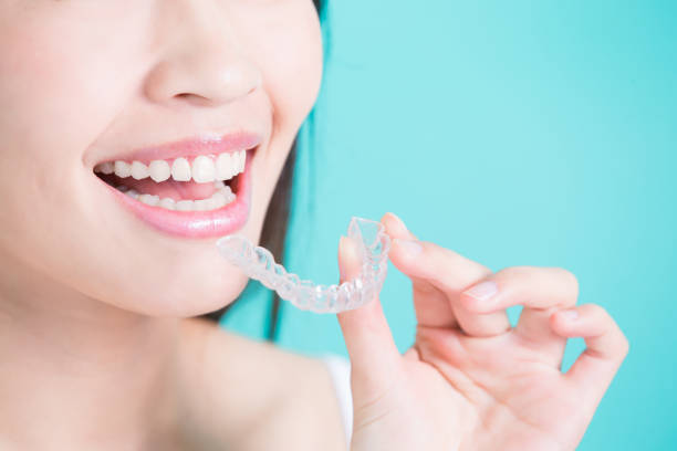 istock woman take invisible braces 690823268