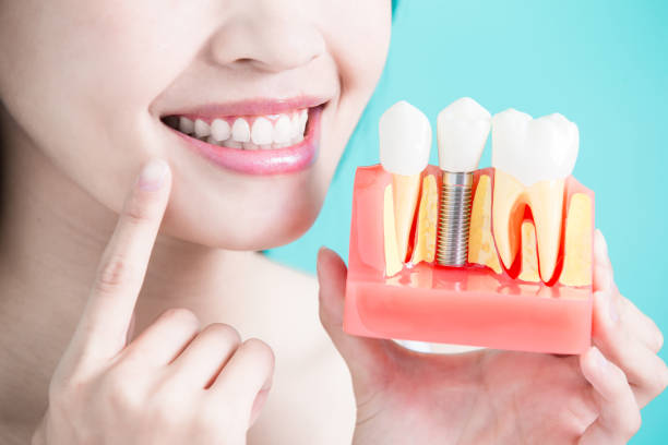 healthy dental concept stock photo