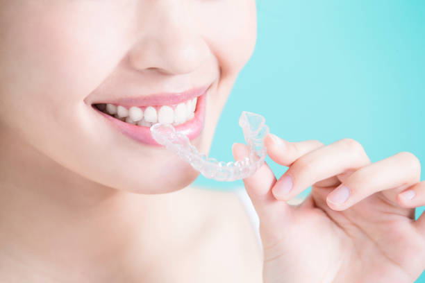 istock woman take invisible braces 690845238