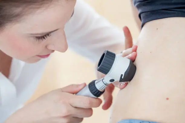 Dermatologist inspecting patient skin moles