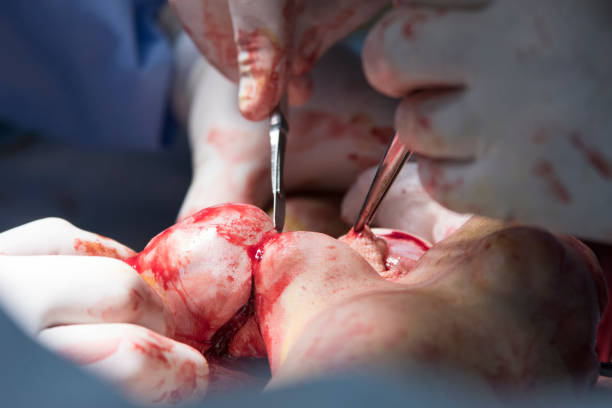 istock Cut With Scalpel Close Up 691099050