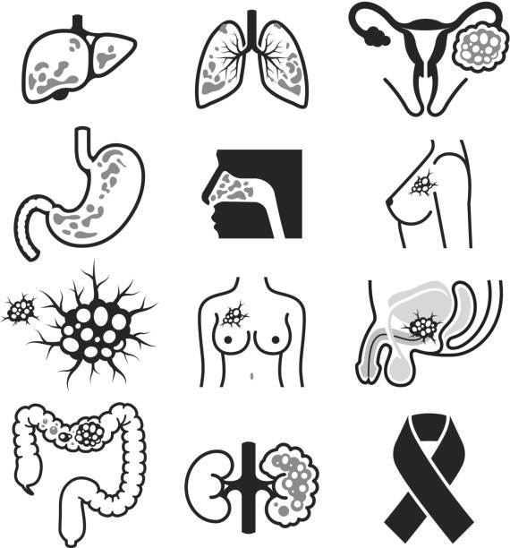 ilustraciones, imágenes clip art, dibujos animados e iconos de stock de conjunto de iconos de cáncer. - seno ilustraciones