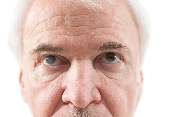 enfermedad de los ojos en hombres de edad avanzada - pain human eye senior adult men fotografías e imágenes de stock