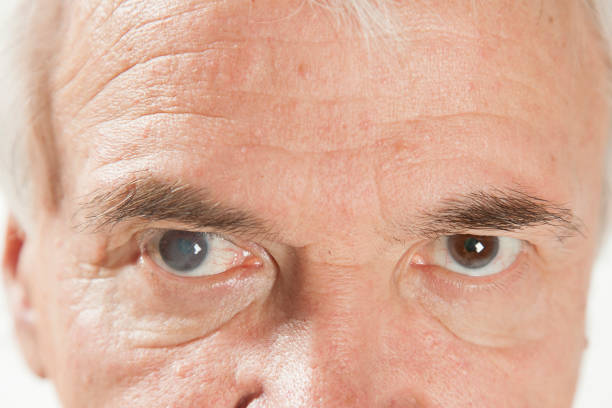 노인 남성에서 안과 질환 - pain human eye senior adult men 뉴스 사진 이미지