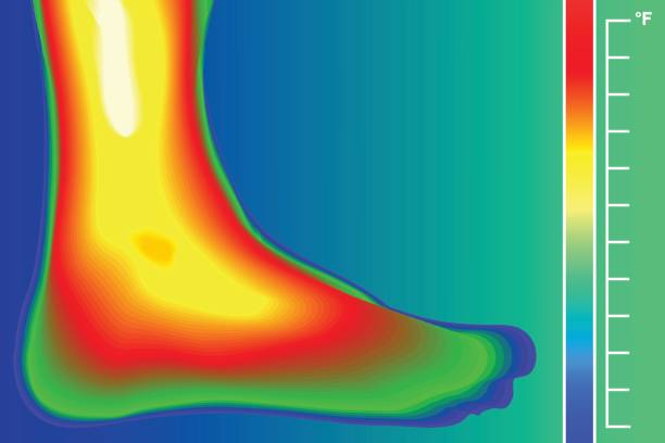 istock Human Leg. Infrared Thermograph with temperature scale. Infrared energy scan Actual temperature. 691753530