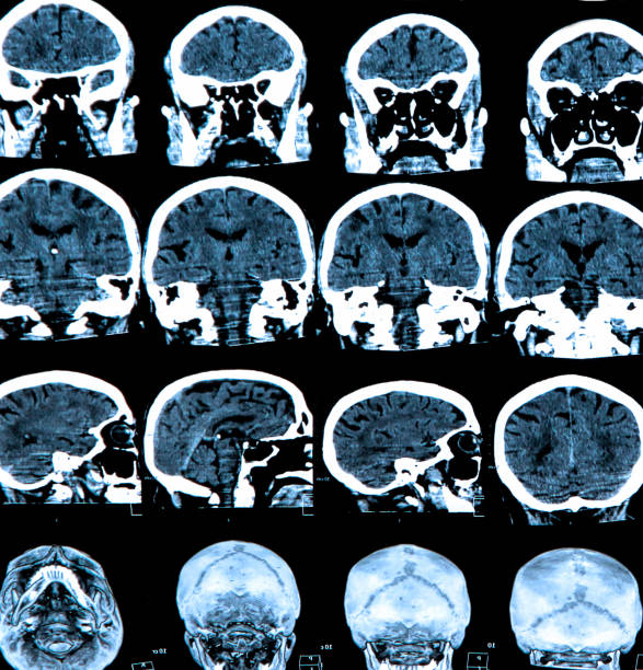 cerebro humano - phase image mri scan science nobody fotografías e imágenes de stock