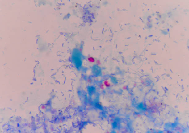 red cells cryptosporidium oocyte on blue background. - microscop imagens e fotografias de stock