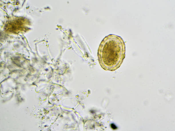 istock Ascaris lumbricoides (roundworm) 692169258