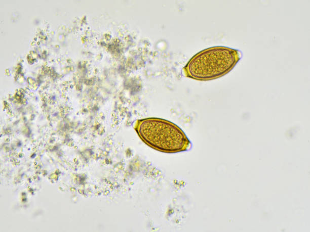 istock Trichuris trichiura (egg) 692169416